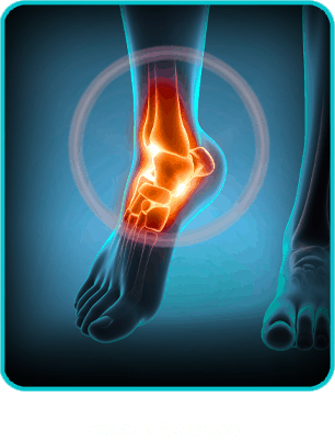 Ankle Injury Surgery